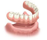 removable full denture arch